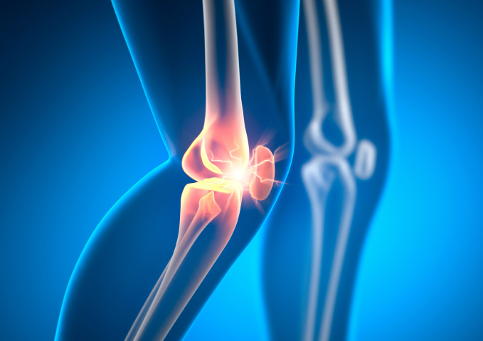 Image of Knee Injury