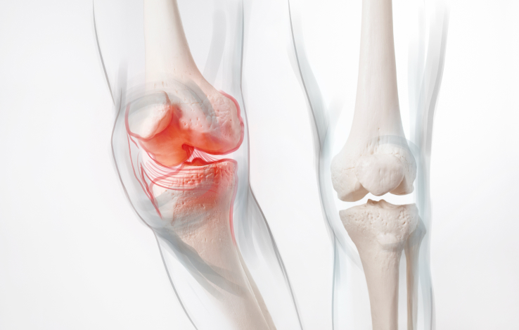 Image of Knee Injury